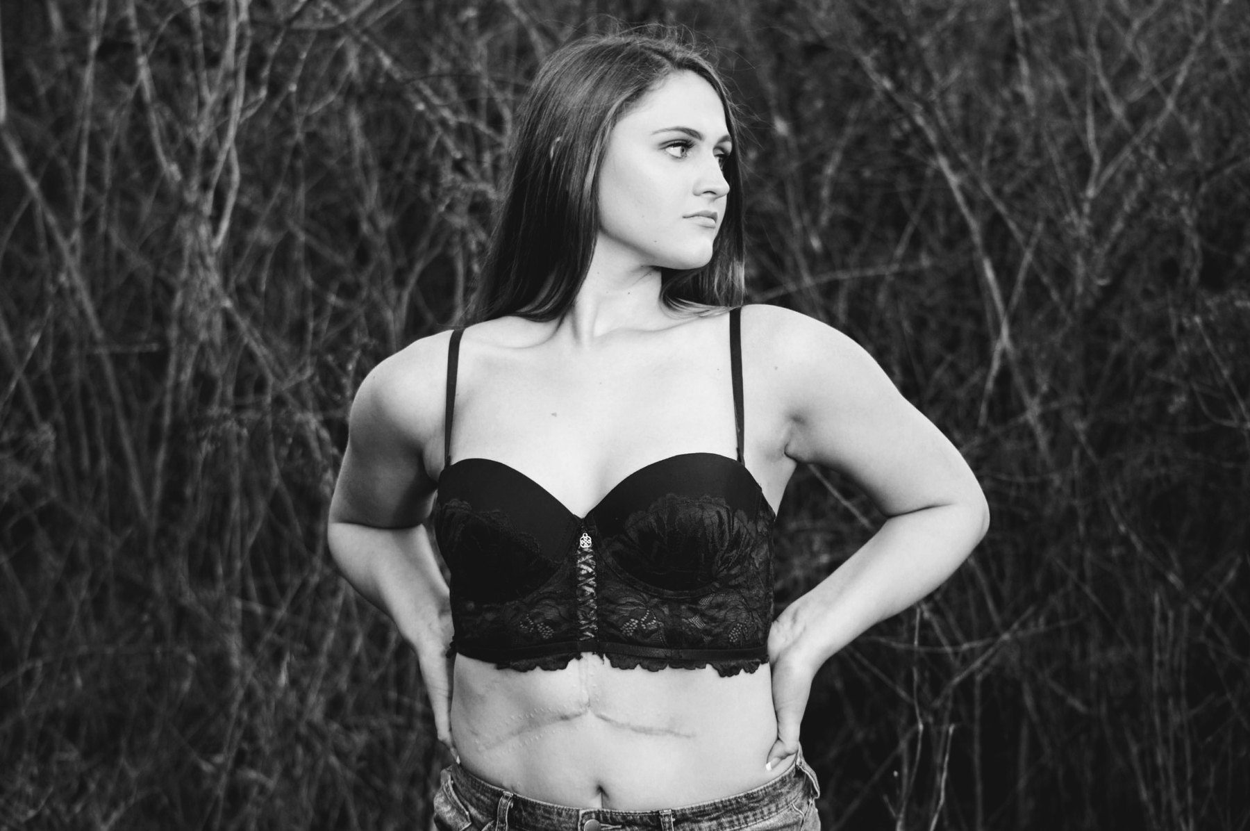 Black-and-white portrait focused on bare skin, scars, and outdoor texture